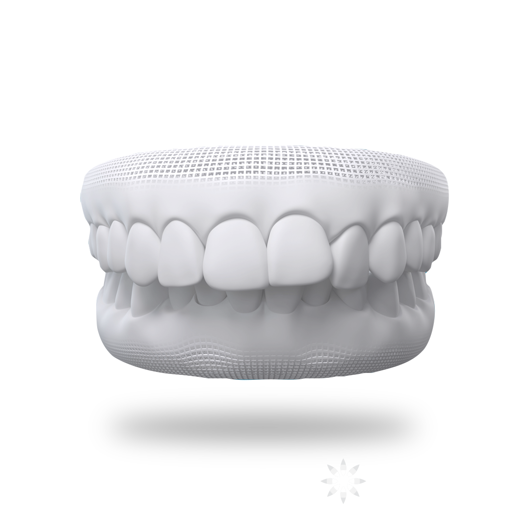 Overbite Teeth